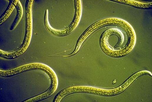 Parasitic worms nematodes in the small intestine of man